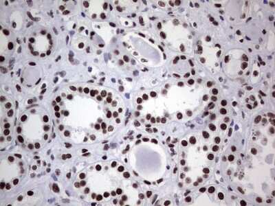 Immunohistochemistry: NIPP1 Antibody (4E5) [NBP2-45386] - Analysis of Human Kidney tissue. (Heat-induced epitope retrieval by 1 mM EDTA in 10mM Tris, pH8.5, 120C for 3min)