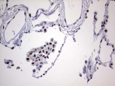 Immunohistochemistry: NIPP1 Antibody (4E5) [NBP2-45386] - Analysis of Human lung tissue. (Heat-induced epitope retrieval by 1 mM EDTA in 10mM Tris, pH8.5, 120C for 3min)