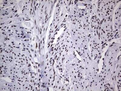 Immunohistochemistry: NIPP1 Antibody (4E5) [NBP2-45386] - Analysis of Human endometrium tissue. (Heat-induced epitope retrieval by 1 mM EDTA in 10mM Tris, pH8.5, 120C for 3min)