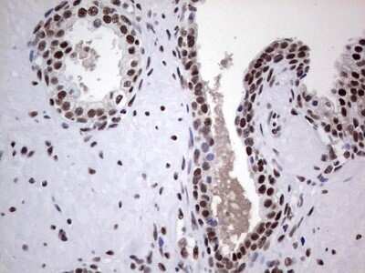 Immunohistochemistry: NIPP1 Antibody (4E5) [NBP2-45386] - Analysis of Human prostate tissue. (Heat-induced epitope retrieval by 1 mM EDTA in 10mM Tris, pH8.5, 120C for 3min)