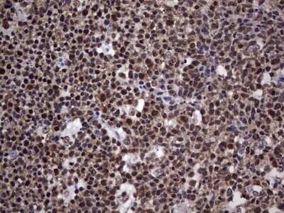 Immunohistochemistry: NIPP1 Antibody (4E5) [NBP2-45386] - Analysis of Human tonsil tissue. (Heat-induced epitope retrieval by 1 mM EDTA in 10mM Tris, pH8.5, 120C for 3min)