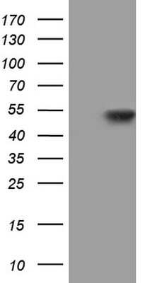 Western Blot: NIPP1 Antibody (4E5) [NBP2-45386] - Analysis of HEK293T cells were transfected with the pCMV6-ENTRY control (Left lane) or pCMV6-ENTRY NIPP1.