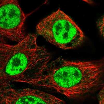 Immunocytochemistry/Immunofluorescence: NIPP1 Antibody [NBP1-90111] - Staining of human cell line A-431 shows localization to nuclear speckles.