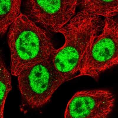 <b>Independent Antibodies Validation. </b>Immunocytochemistry/Immunofluorescence: NIPP1 Antibody [NBP1-90112] - Staining of human cell line A-431 shows localization to nuclear speckles.