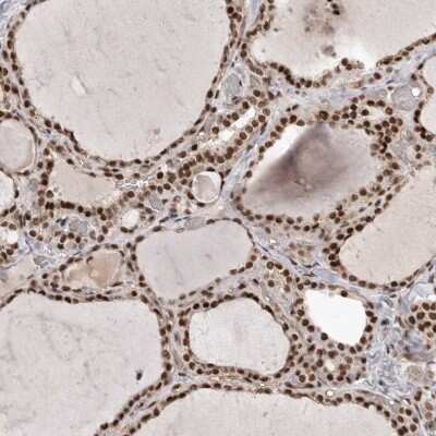 Immunohistochemistry-Paraffin: NIPP1 Antibody [NBP1-90112] - Staining of human thyroid gland shows strong nuclear positivity in glandular cells.