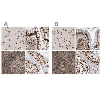 <b>Independent Antibodies Validation. </b>Immunohistochemistry-Paraffin: NIPP1 Antibody [NBP1-90112] - Staining of human cerebral cortex, colon, lymph node and testis using Anti-PPP1R8 antibody NBP1-90112 (A) shows similar protein distribution across tissues to independent antibody NBP1-90113 (B).