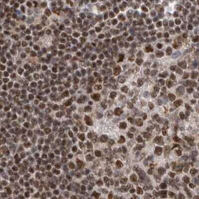 Immunohistochemistry-Paraffin: NIPP1 Antibody [NBP1-90112] - Staining of human lymph node.