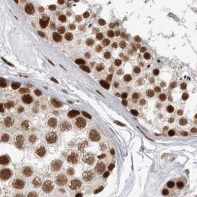 Immunohistochemistry-Paraffin: NIPP1 Antibody [NBP1-90112] - Staining of human testis.