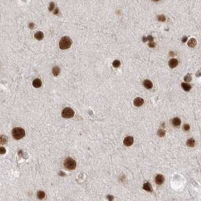 Immunohistochemistry-Paraffin: NIPP1 Antibody [NBP1-90112] - Staining of human cerebral cortex.