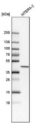 Western Blot: NIPP1 Antibody [NBP1-90111] - Analysis in human cell line NTERA-2.