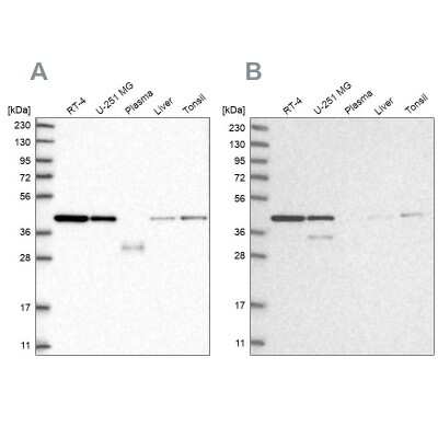 Western Blot: NIPP1 Antibody [NBP1-90112] - Analysis using Anti-PPP1R8 antibody NBP1-90112 (A) shows similar pattern to independent antibody NBP1-90113 (B).