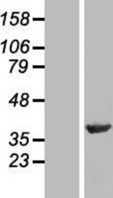 Western Blot: NIPP1 Overexpression Lysate (Adult Normal) [NBL1-14687] Left-Empty vector transfected control cell lysate (HEK293 cell lysate); Right -Over-expression Lysate for NIPP1.