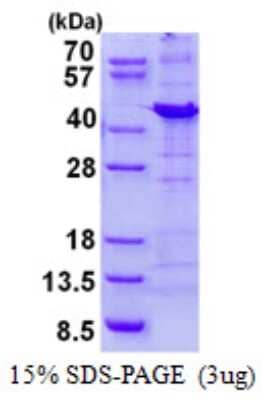 SDS-Page: NIPP1 Protein [NBP2-23382]