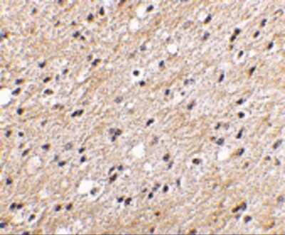 Immunohistochemistry NIPSNAP1 Antibody - BSA Free