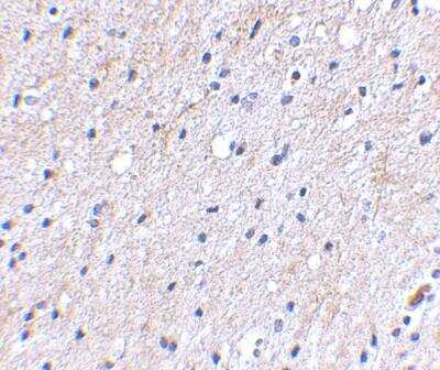 Immunohistochemistry-Paraffin: NIPSNAP1 Antibody [NBP1-76887] - Human brain tissue using Nipsnap1 antibody at 2.5 ug/ml.