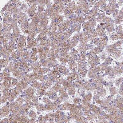 Immunohistochemistry-Paraffin: NIPSNAP1 Antibody [NBP2-31755] - Staining of human liver shows weak cytoplasmic positivity in hepatocytes.