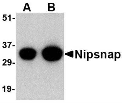 Western Blot: NIPSNAP1 Antibody [NBP1-76887] - Human brain tissue lysate with NIPSNAP antibody at (A) 0.5 and (B) 1 ug/ml.