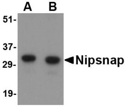 Western Blot NIPSNAP1 Antibody - BSA Free