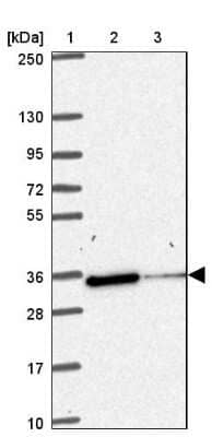 Western Blot: NIPSNAP1 Antibody [NBP2-31755] - Lane 1: Marker  [kDa] 250, 130, 95, 72, 55, 36, 28, 17, 10.  Lane 2: Human cell line RT-4.  Lane 3: Human cell line U-251MG sp