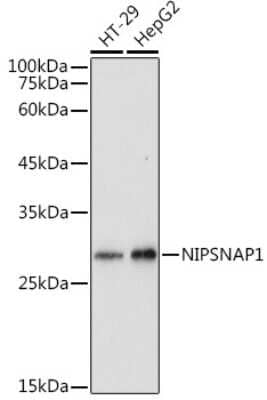 Western Blot: NIPSNAP1 Antibody [NBP3-05243] - Western blot analysis of extracts of various cell lines, using NIPSNAP1 antibody (NBP3-05243) at 1:1000 dilution. Secondary antibody: HRP Goat Anti-Rabbit IgG (H+L) at 1:10000 dilution. Lysates/proteins: 25ug per lane. Blocking buffer: 3% nonfat dry milk in TBST. Detection: ECL Basic Kit. Exposure time: 1s.