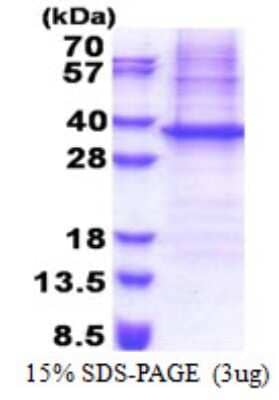 SDS-Page: NIPSNAP1 Protein [NBP2-23289]