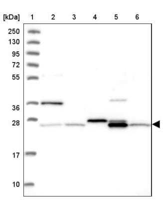 Western Blot NIPSNAP3A Antibody