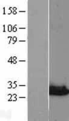 Western Blot NIPSNAP3A Overexpression Lysate