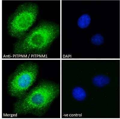 Immunocytochemistry/Immunofluorescence: NIR2 Antibody [NB100-1417] - Immunofluorescence analysis of paraformaldehyde fixed A549 cells, permeabilized with 0.15% Triton. Primary incubation 1hr (10ug/ml) followed by Alexa Fluor 488 secondary antibody (2ug/ml), showing cytoplasmic and Endoplasmic Reticulum staining. The nuclear stain is DAPI (blue). Negative control: Unimmunized goat IgG (10ug/ml) followed by Alexa Fluor 488 secondary antibody (2ug/ml).