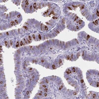 Immunohistochemistry-Paraffin: NIR2 Antibody [NBP2-34132] - Staining of human fallopian tube shows cytoplasmic positivity in glandular cells.