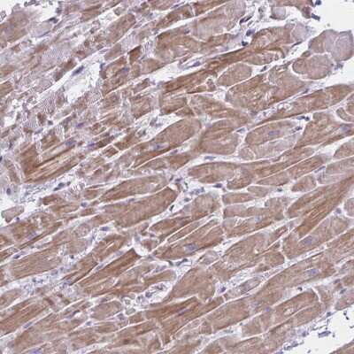 Immunohistochemistry-Paraffin: NIR2 Antibody [NBP2-34132] - Staining of human Heart muscle shows moderate cytoplasmic positivity in cardiomyocytes.