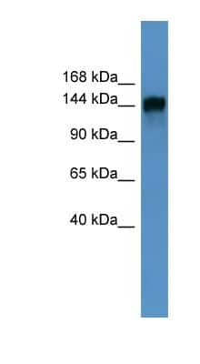 Western Blot: NIR2 Antibody [NBP1-69043] - Human Heart lysate, concentration 0.2-1 ug/ml.