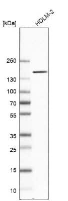 Western Blot: NIR2 Antibody [NBP2-34132] - TEST