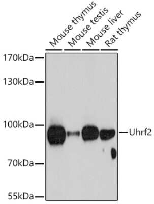 Western Blot: NIRF Antibody [NBP2-94602] - Analysis of extracts of various cell lines, using NIRF at 1:1000 dilution. Secondary antibody: HRP Goat Anti-Rabbit IgG (H+L) at 1:10000 dilution. Lysates/proteins: 25ug per lane. Blocking buffer: 3% nonfat dry milk in TBST. Detection: ECL Basic Kit . Exposure time: 60s.