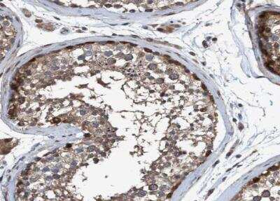 Immunohistochemistry-Paraffin NISCH Antibody