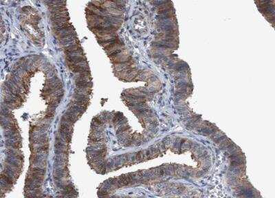 Immunohistochemistry-Paraffin NISCH Antibody