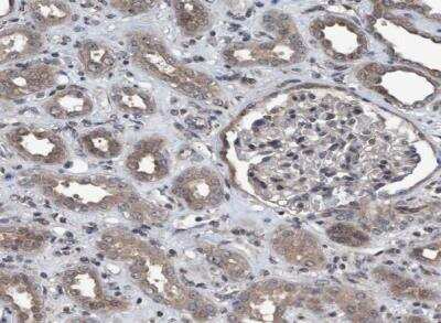 Immunohistochemistry-Paraffin NISCH Antibody