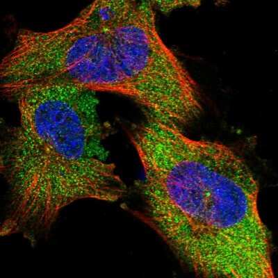 Immunocytochemistry/Immunofluorescence: NIT2 Antibody [NBP1-89486] - Immunofluorescent staining of human cell line U-251 MG shows localization to cytosol & centrosome.