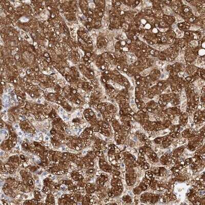 Immunohistochemistry-Paraffin: NIT2 Antibody [NBP1-89486] - Staining of human liver shows strong cytoplasmic positivity in hepatocytes.
