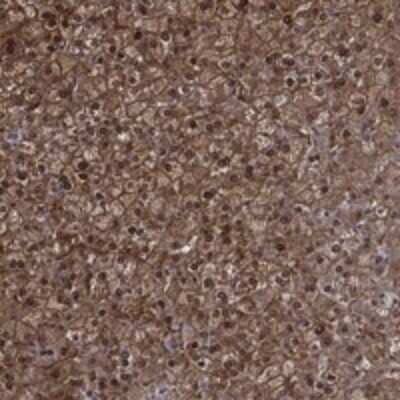 Immunohistochemistry-Paraffin: NIT2 Antibody [NBP3-17403] - Staining of human liver shows strong cytoplasmic and nuclear positivity in hepatocytes.