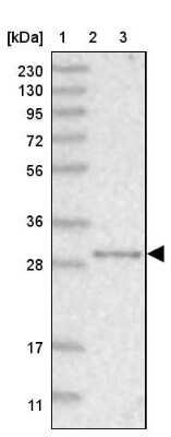 Western Blot: NIT2 Antibody [NBP1-89486] - Lane 1: Marker  [kDa] 230, 130, 95, 72, 56, 36, 28, 17, 11.  Lane 2: Human cell line RT-4.  Lane 3: Human plasma (IgG/HSA depleted)