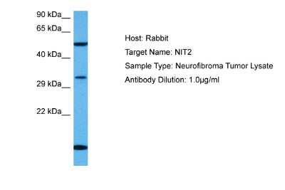 Western Blot: NIT2 Antibody [NBP2-85382] - Host: Rabbit. Target Name: NIT2. Sample Tissue: Human Neurofibroma Tumor lysates. Antibody Dilution: 1ug/ml