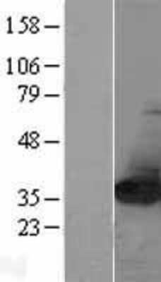 Western Blot NIT2 Overexpression Lysate