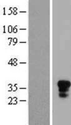 Western Blot: NK1.1 Overexpression Lysate (Adult Normal) [NBP2-10818] Left-Empty vector transfected control cell lysate (HEK293 cell lysate); Right -Over-expression Lysate for NK1.1.