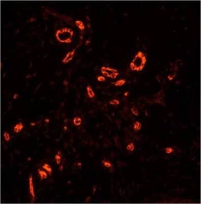 Immunocytochemistry: NK1R Antibody [NB100-74469] - Neurokinin 1 Receptor staining in paraffin-embedded human skin tissue. Tissue sections were stained with Neurokinin 1 Receptor Polyclonal Antibody at a dilution of 1:750 followed by anti-rabbit IgG-HRP secondary and a fluorescently-conjugated tyramide reagent (red). Data courtesy of the Innovators Program.