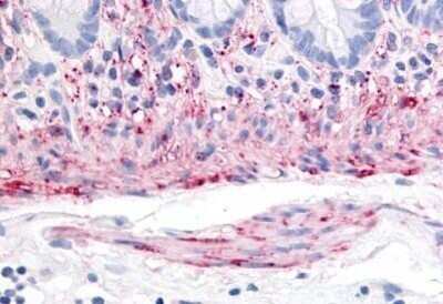 Immunohistochemistry-Paraffin: NK2R Antibody [NB100-58993] - Analysis of anti-Neurokinin A Receptor antibody with human colon, smooth muscle at concentration 20 ug/ml.