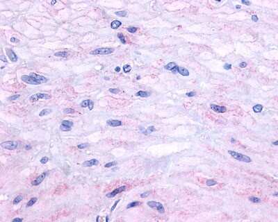 Immunohistochemistry-Paraffin: NK2R Antibody [NLS1287] - Analysis of anti-Neurokinin A Receptor antibody with human small intestine, muscularis propria.