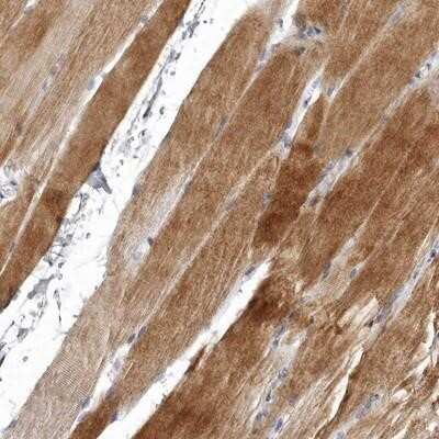 Immunohistochemistry-Paraffin: NKAIN4 Antibody [NBP1-90809] - Staining of human skeletal muscle shows moderate cytoplasmic positivity in myocytes.