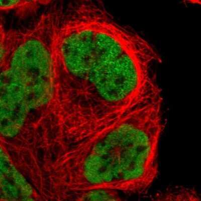 Immunocytochemistry/ Immunofluorescence NKAP Antibody - BSA Free