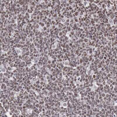 Immunohistochemistry-Paraffin: NKAP Antibody [NBP1-82117] - Staining of human tonsil shows nuclear positivity in lymphoid cells.