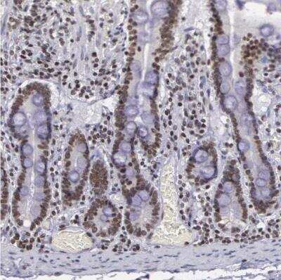 Immunohistochemistry-Paraffin: NKAP Antibody [NBP1-82117] - Staining of human small intestine shows moderate nuclear positivity in glandular cells.